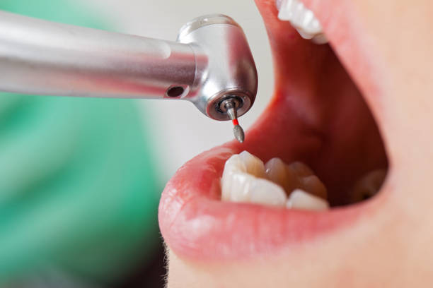 Best Emergency Dental Care for Broken or Chipped Teeth in Curwensville, PA